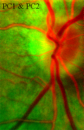  retinal imaging